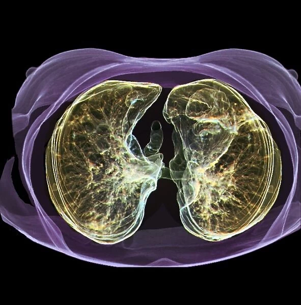 Healthy lungs, 3D CT scan C016  /  6502