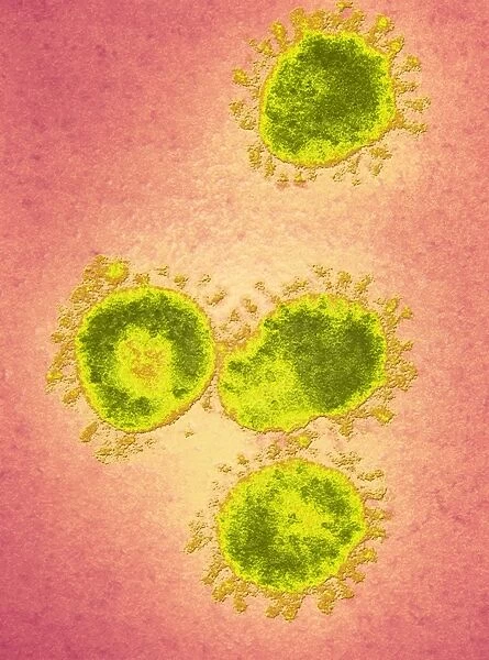 Infectious bronchitis virus (IBV), TEM