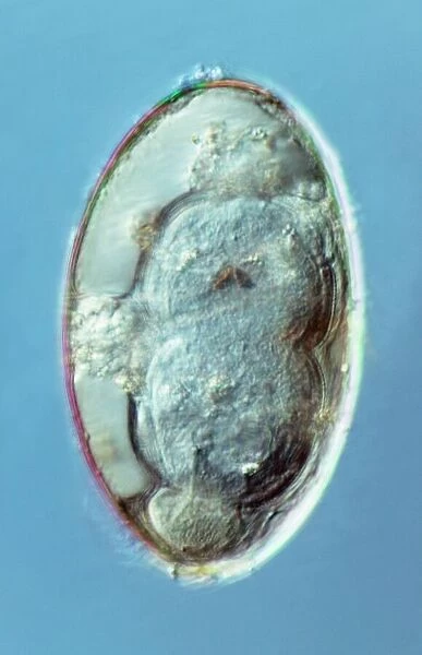 Liver fluke egg, macro photograph