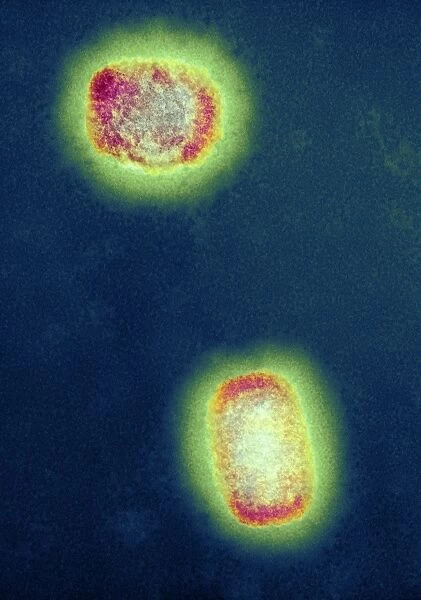 Monkeypox virus particles, TEM C016  /  7385