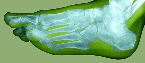 Normal foot, X-ray