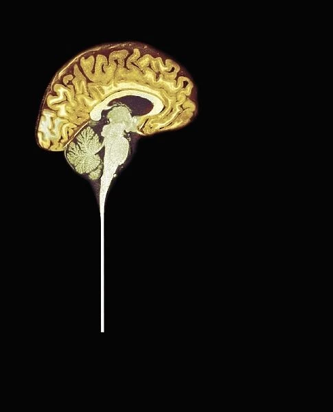 Normal human brain, MRI scan C016  /  8843