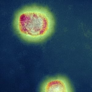 Monkeypox virus particles, TEM C016 / 7385