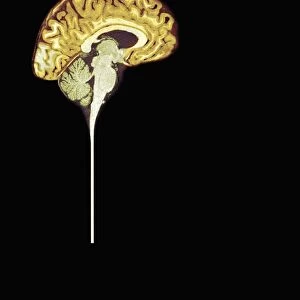 Normal human brain, MRI scan C016 / 8843