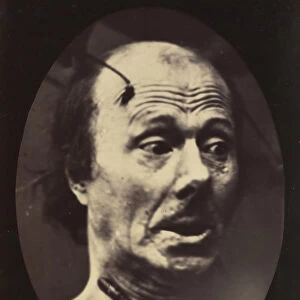 Figure 60: Fright, 1854-56, printed 1862. Creators: Duchenne de Boulogne
