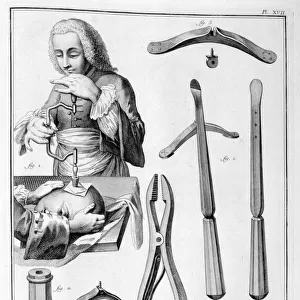 Head surgery, 1751-1777